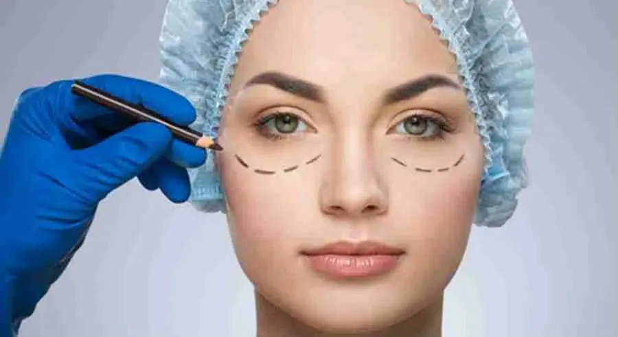 Blefaroplastia: Renovando tu Mirada con Elegancia y Precisión