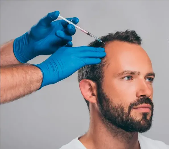 Mesoterapia capilar en Valencia: Solución avanzada para la salud del cabello